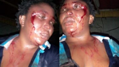 Photo of Outrage as man batters his wife then brags about it on Facebook by sharing photos of her bleeding face
