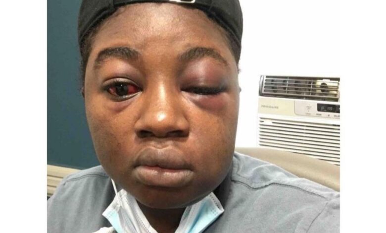 "Nigeria has failed me," Woman kidnapped, beaten & raped for several days shares horrific experience, says police collected bribe instead of checking car 1