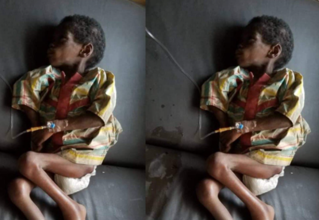 Malnourished 7-year-old girl starved and neglected by her aunt is rescued in Osun state 1 Malnourished 7-year-old girl starved and neglected by her aunt is rescued in Osun state 1