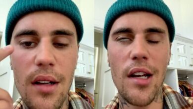 Photo of I know this storm will pass, Jesus is with me – Justin Bieber speaks on struggle with facial paralysis