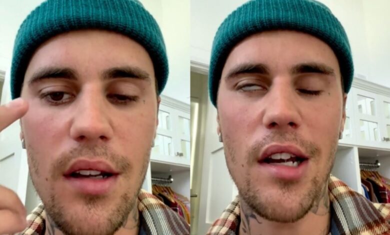 I know this storm will pass, Jesus is with me - Justin Bieber speaks on struggle with facial paralysis 1