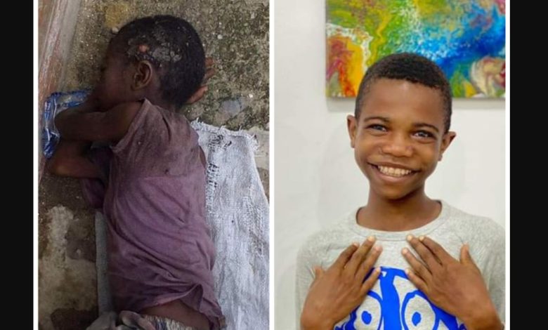 Amazing transformation of young boy rescued 5 years ago after he was branded a witch, ostracized & left to die on the streets of Akwa Ibom 9 Amazing transformation of young boy rescued 5 years ago after he was branded a witch, ostracized & left to die on the streets of Akwa Ibom 1