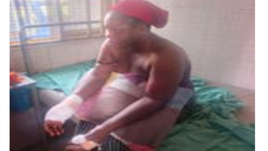 Photo of Abuja court sentences man to two years imprisonment for cutting off woman’s finger after he found her with his friend in a room