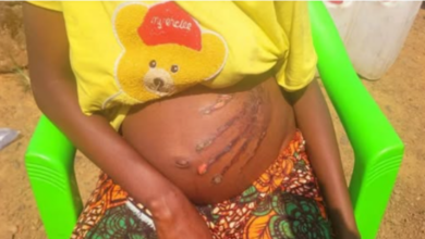 Photo of Pregnant woman who fought with spirit in her dream wakes up to find bloody handprint on her belly